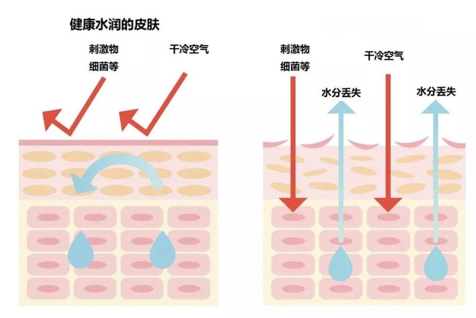 24节气成长指南：孩子总是发痒乱挠，到底是痱子还是湿疹？