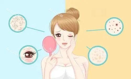 光子嫩肤需要长期做吗？从原理到效果的全面解析