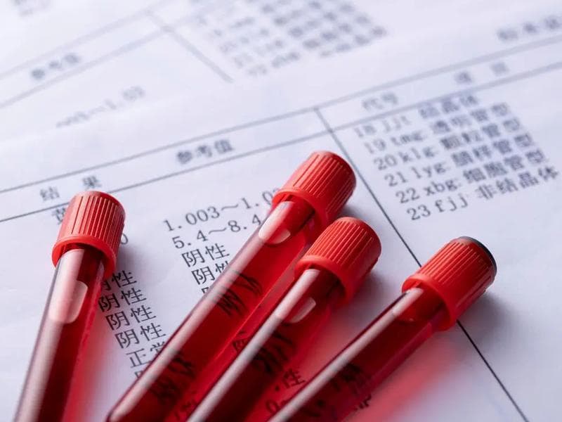 详解血常规各指标参考值，超过正常范围有三大危害