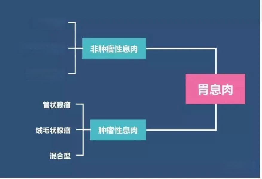 一文讲透——胃息肉