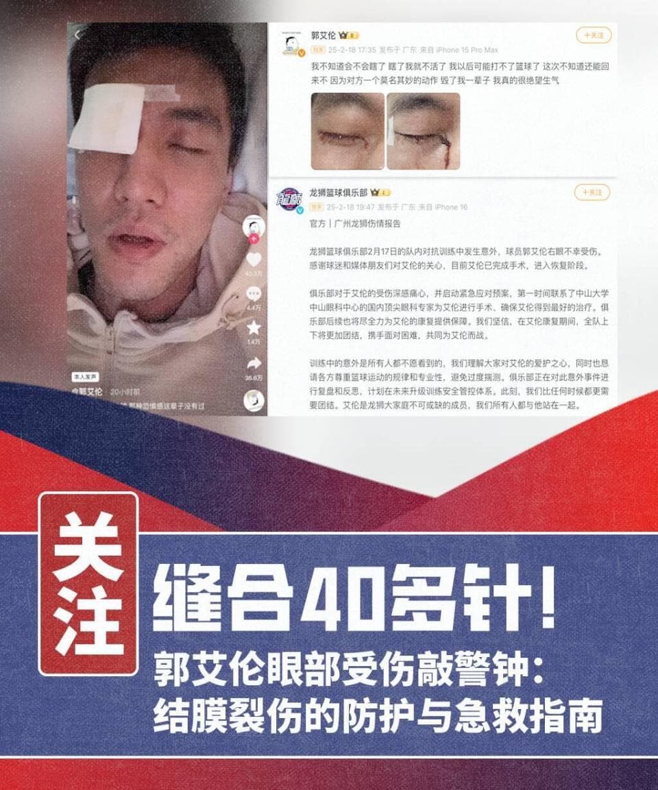 缝合40多针！郭艾伦眼部受伤敲警钟：结膜裂伤的防护与急救指南