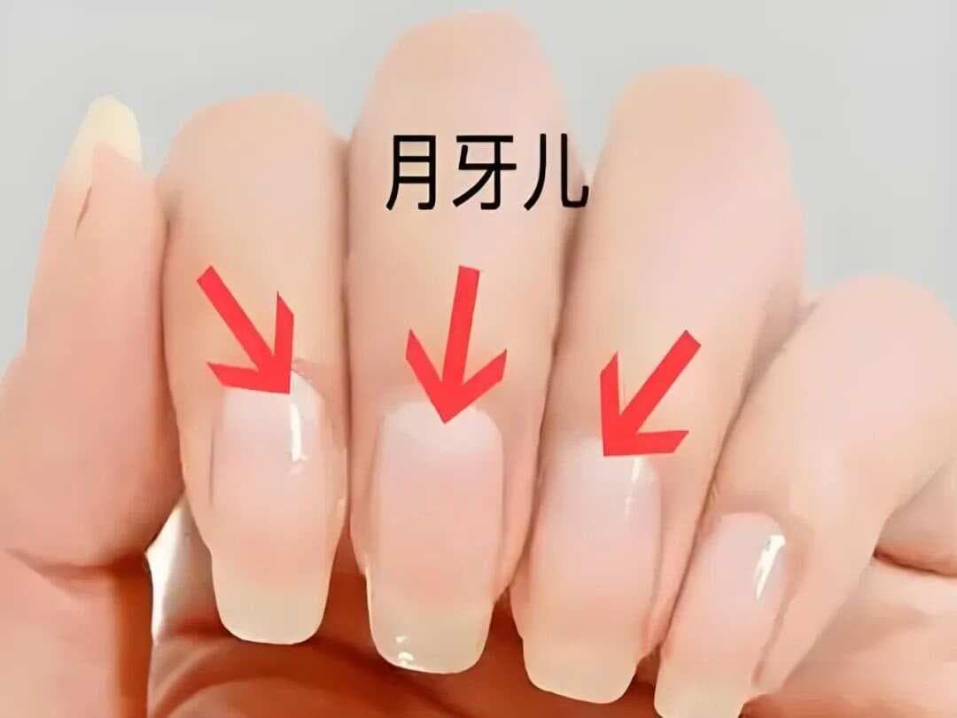 从手指月牙看健康，这些调理方法助你改善体质