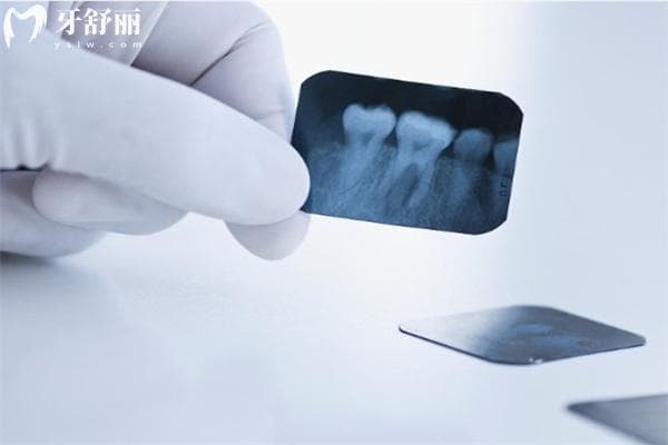 看牙一定要拍CT吗？牙片与CT的区别及必要性分析