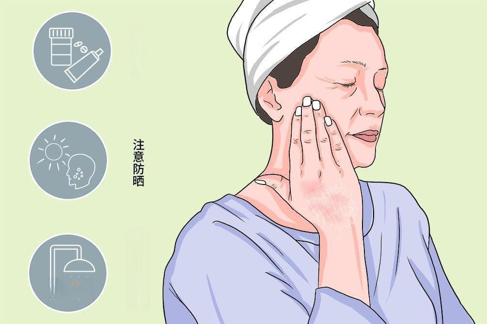 皮肤干燥症：病因、症状、治疗与预防全解析