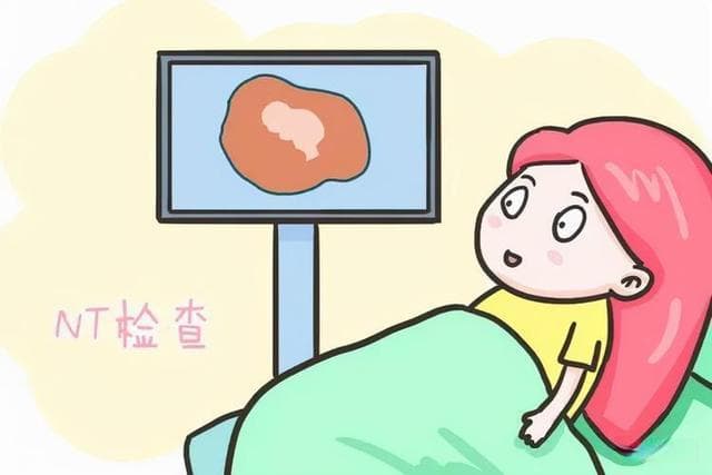 NT是怀孕后的第一次排畸检查，别错过最佳检查时间！