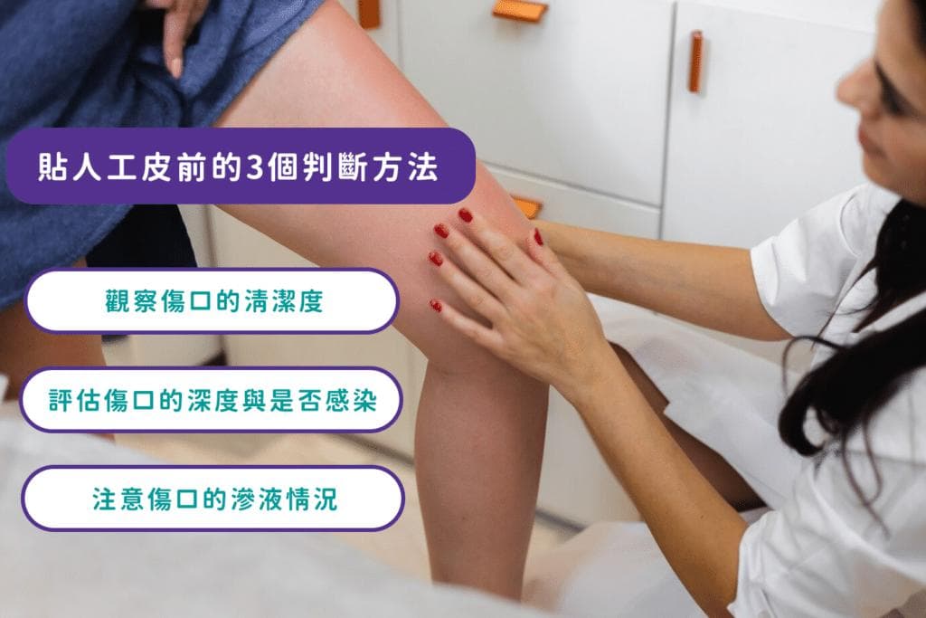 贴人工皮要擦药吗？避免这些错误用法，3方法判断是否该贴人工皮