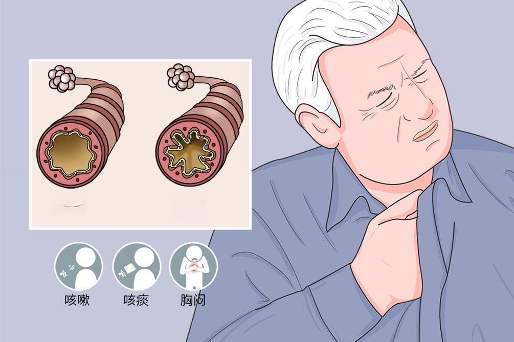 氢氧机对人体有什么作用