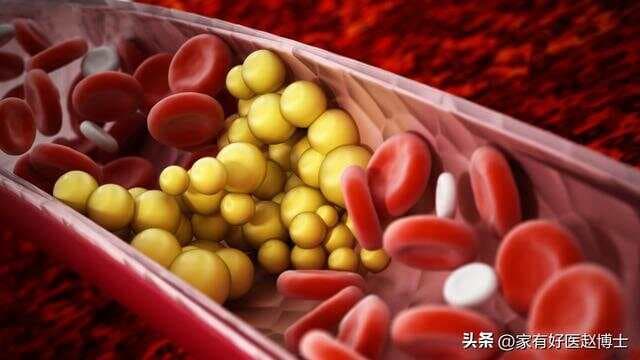降血脂，他汀、血脂康、脂必泰优先吃哪种？看最新血脂指南怎么说
