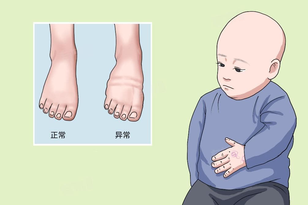 血管性水肿是怎么引起的