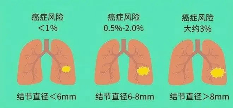 【健康科普】你了解后，还会对肺结节恐慌吗？