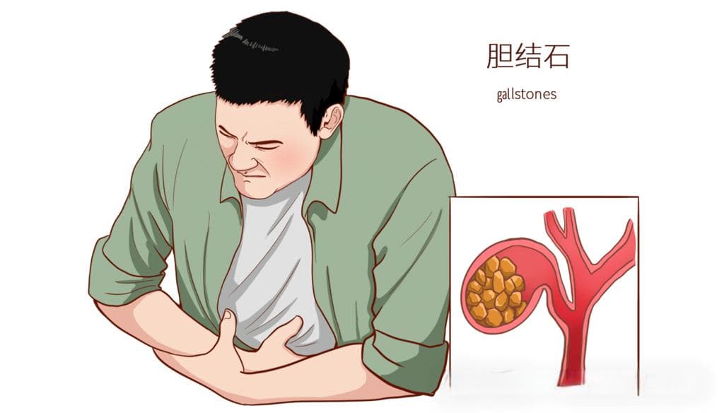 超声评估胆囊收缩功能：原理、方法与结果解读
