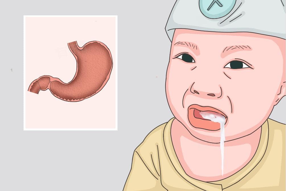 新生儿吐奶的原因及应对措施