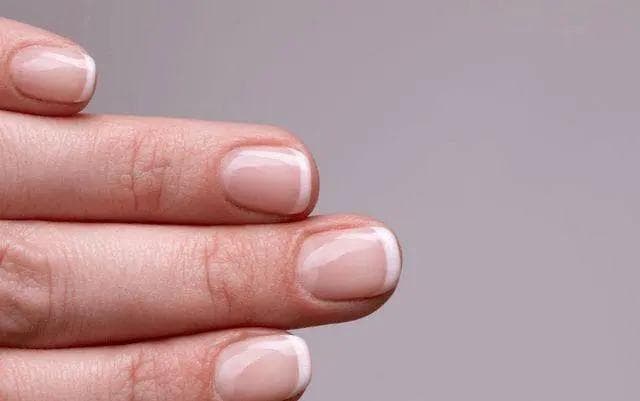 指甲出现竖纹是肝不好？提醒：指甲若出现4种症状，需留心观察