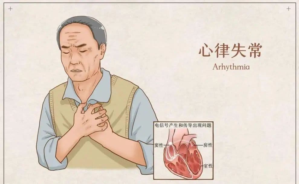 【急救科普】如何应对老年人的缓慢性心律失常