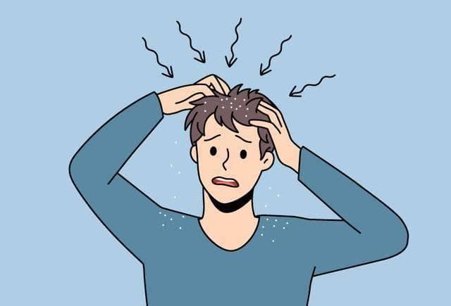 科普 | 脂溢性皮炎是怎么回事儿？
