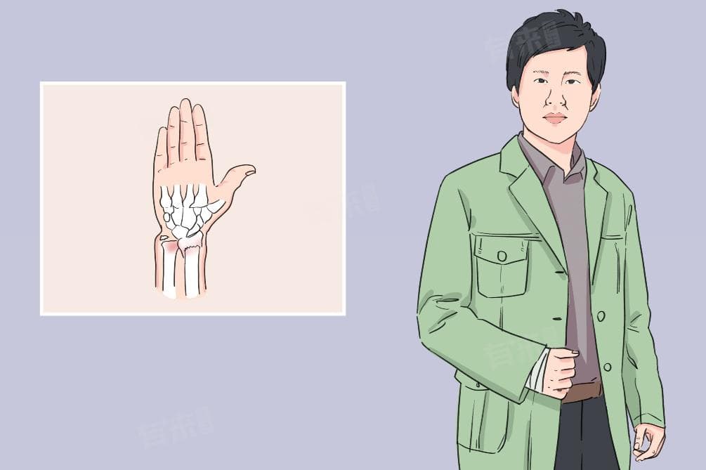骨折后能否喝酒？医生给出专业解答