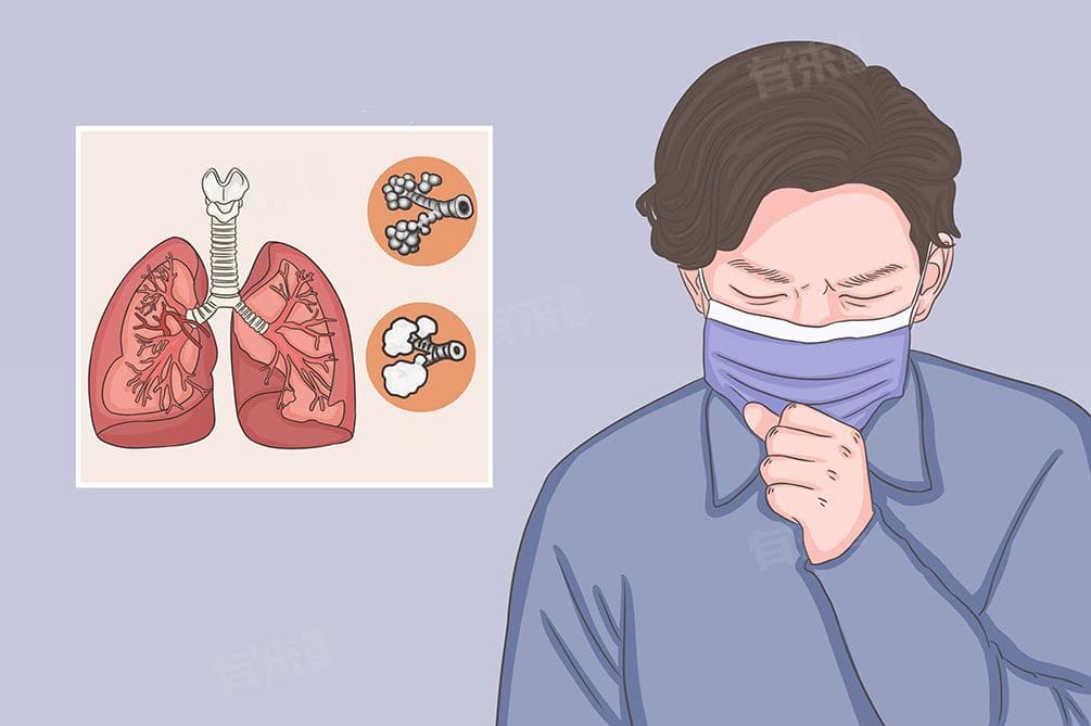支气管炎患者适宜饮品与忌口食物全解析
