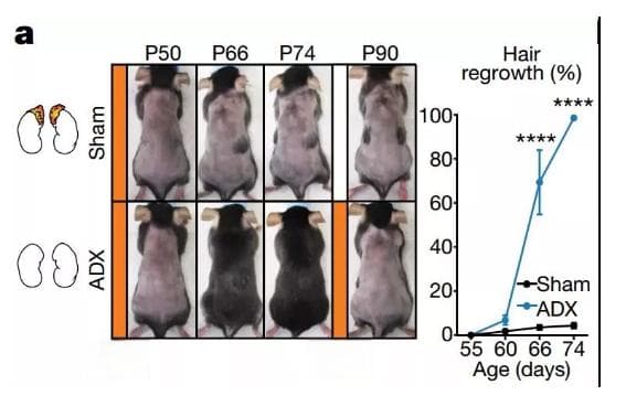 Nature：压力与毛囊干细胞功能障碍存在内在关联机制