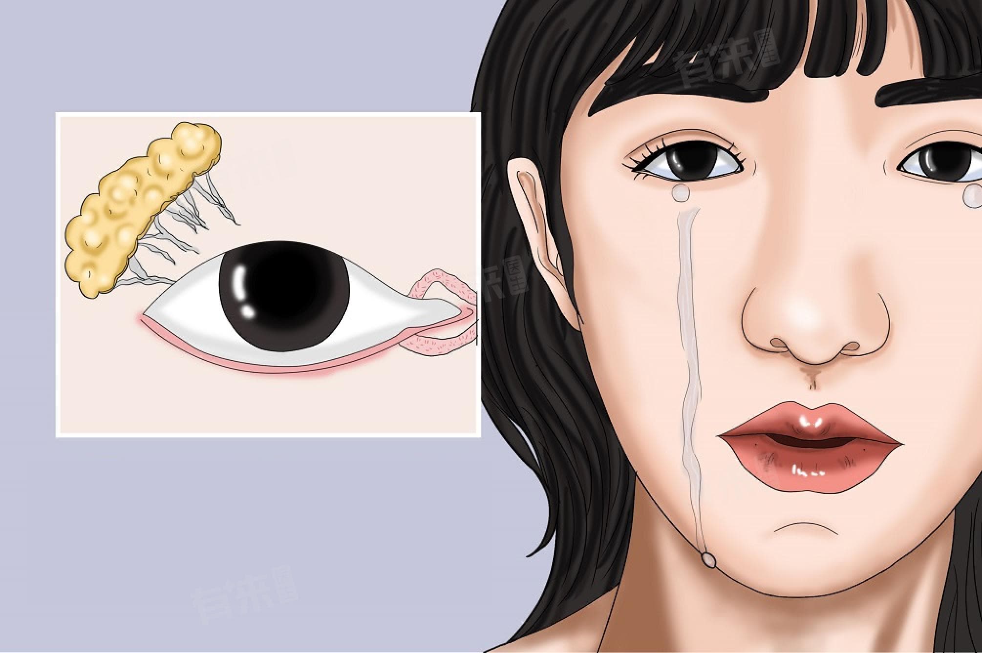 眼睛流泪是什么原因引起的