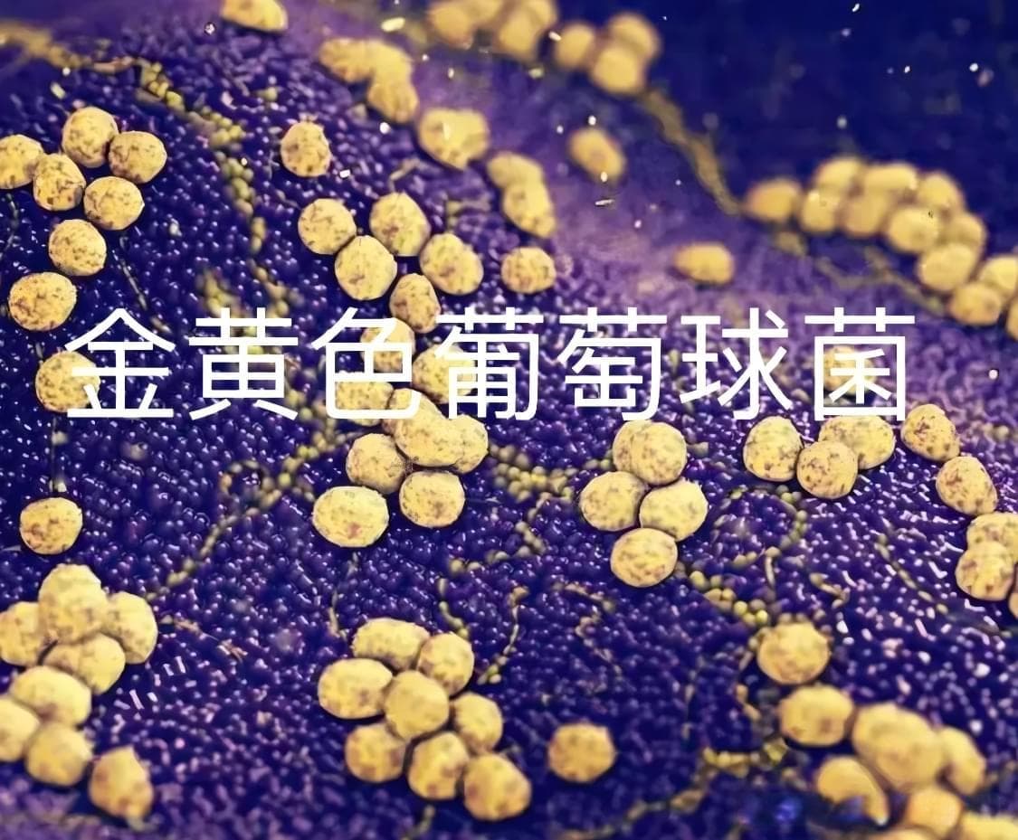 食品中金黄色葡萄球菌检测技术！