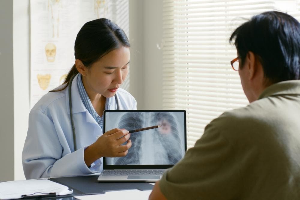 非吸煙者也會得肺癌？揭秘肺癌的五大非傳統風險因素