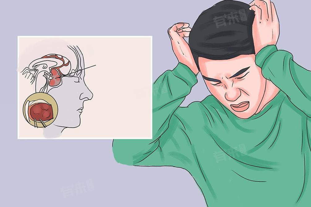 大脑垂体瘤是什么原因引起的