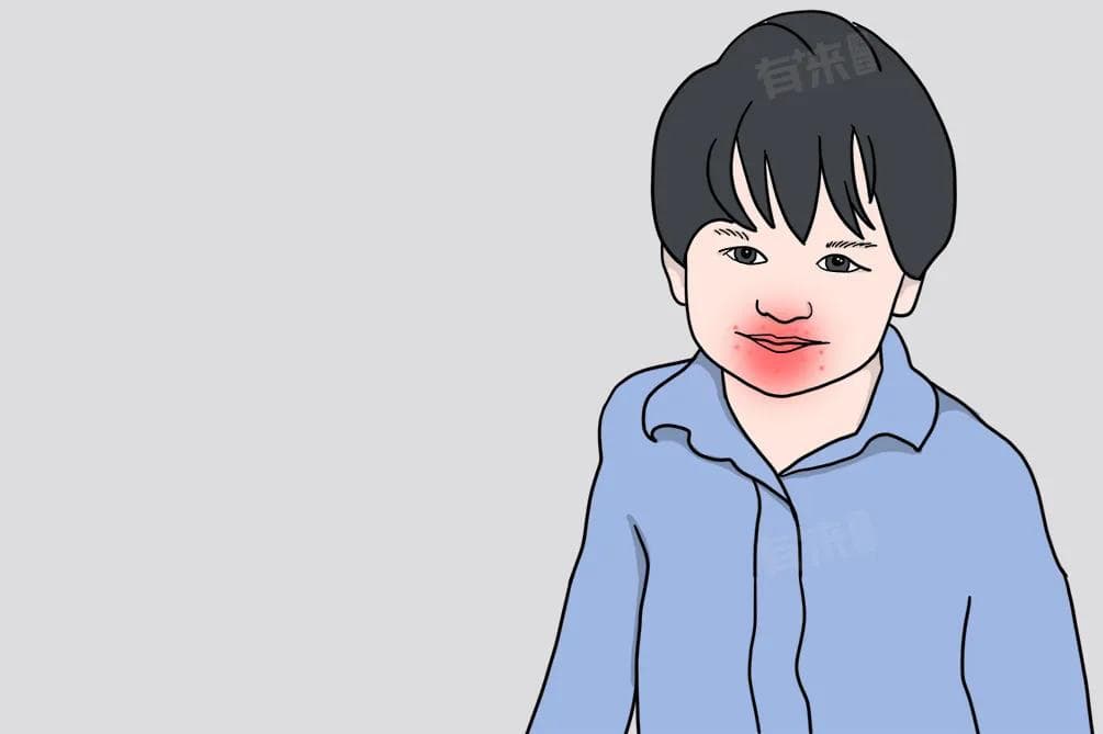 嘴巴里面内壁起泡怎么办