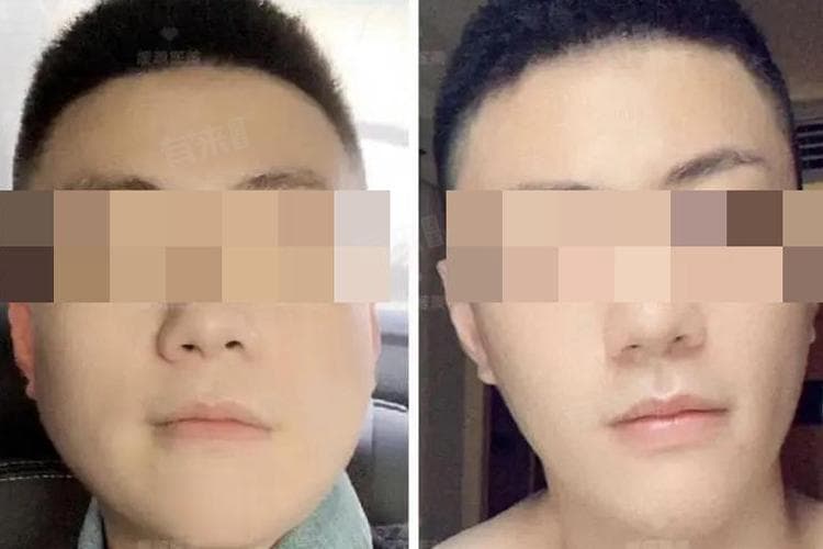 男生瘦脸的最好方法