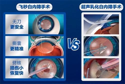 青光眼和白内障是一回事吗？两者有什么区别？可以一起做手术吗？