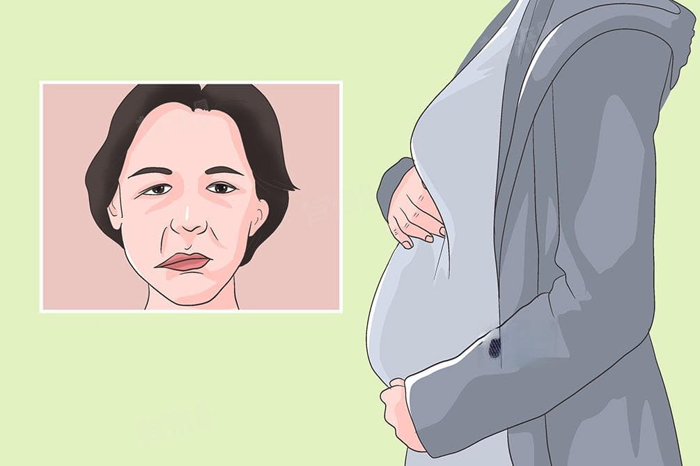 面神经炎的病因及治疗方法
