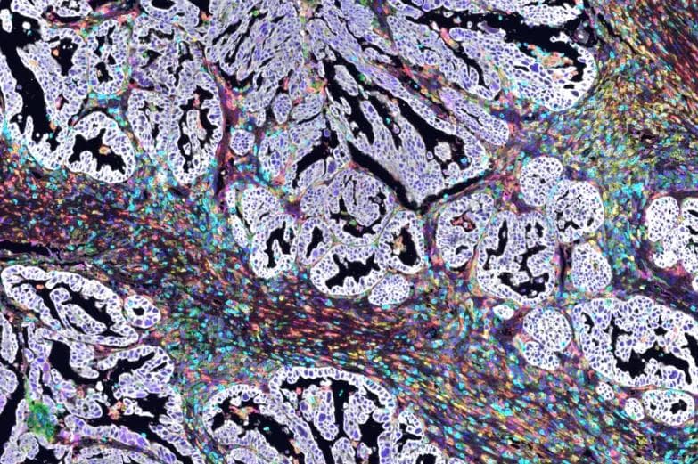 多重免疫荧光实验：原理、优势及在生物医学研究中的应用