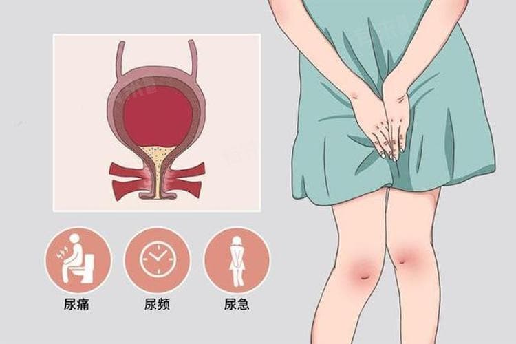 女人尿频是什么原因导致的