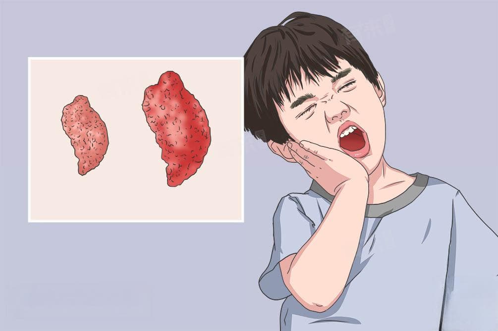 耳朵下方与脸颊交界处有鼓包怎么办？可能病因及检查方法全解析