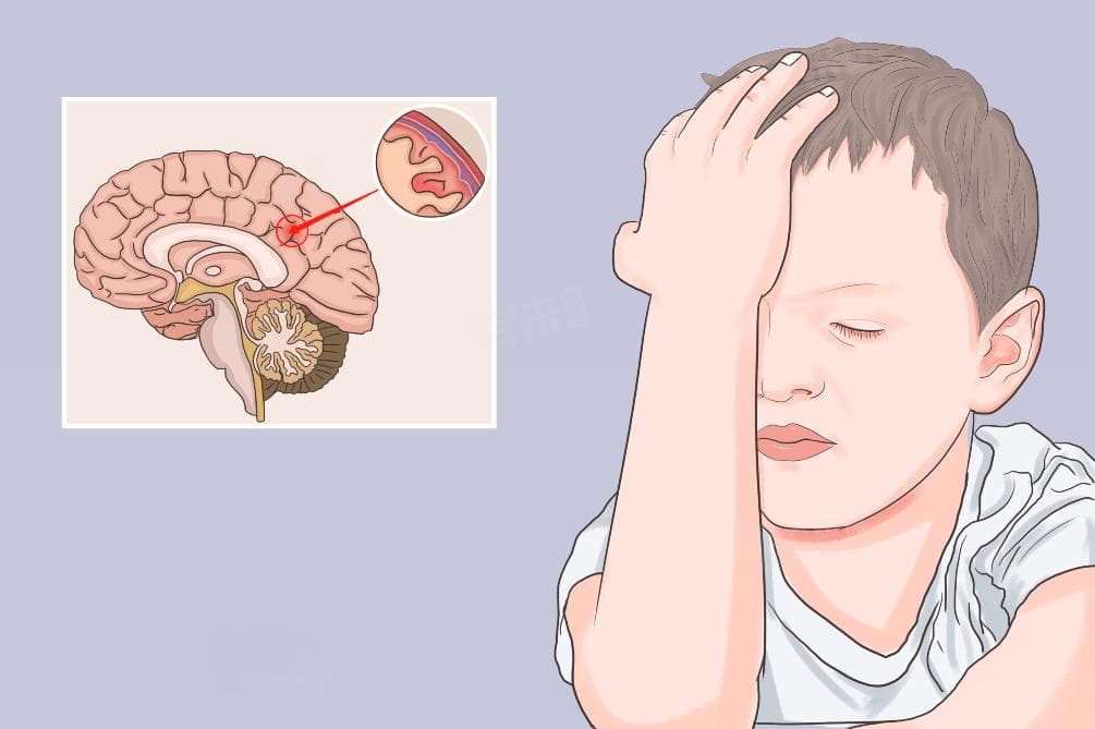 细菌性脑膜炎：致病原因、治疗方法及患者注意事项