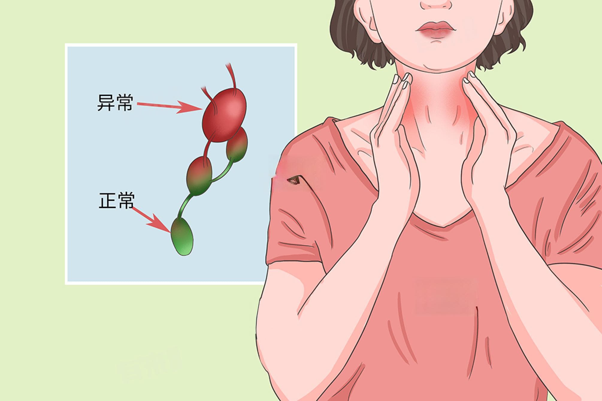 脖子淋巴挂什么科