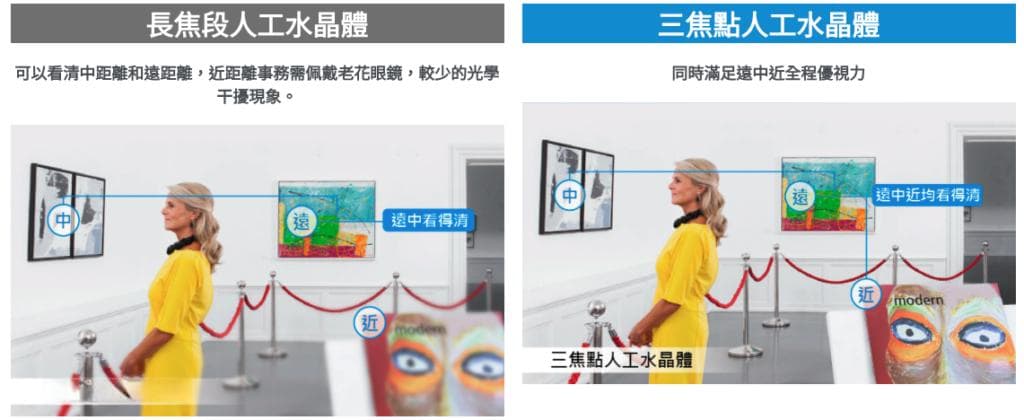白内障手术一定要开刀吗？手术最佳时机、治疗方法及术后须知一次看