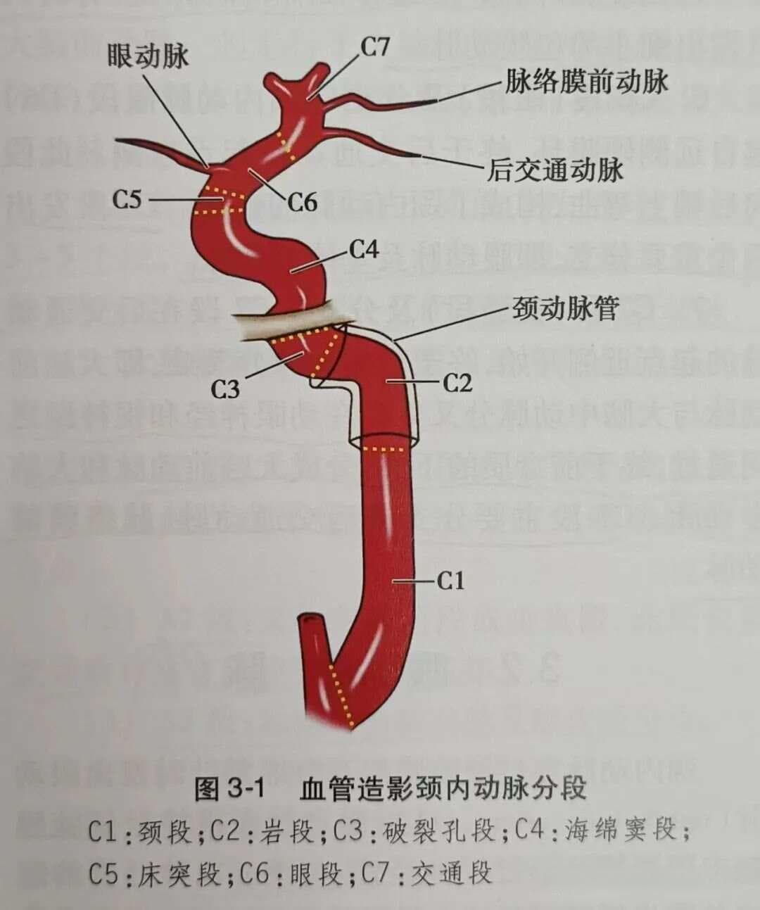 颈动脉的超声解剖