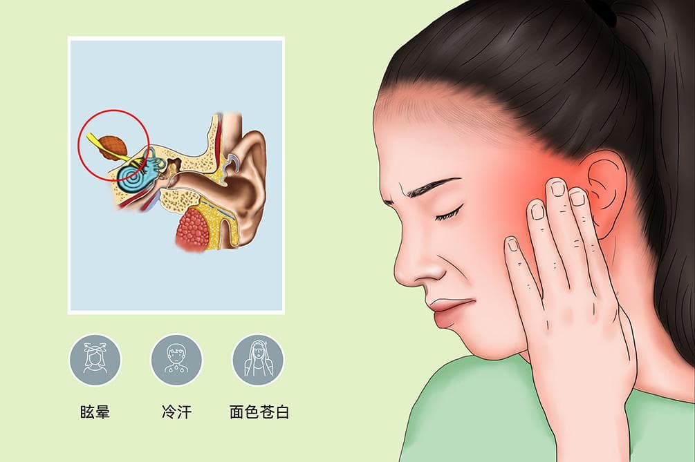 耳源性眩晕