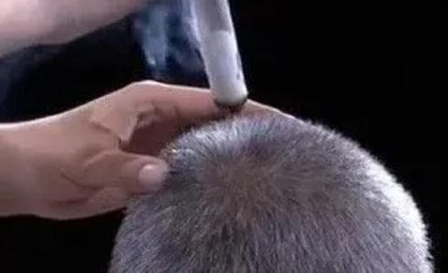 百会穴，是全身经脉总开关！多种疾病都可灸它：头痛、失眠、高血压...