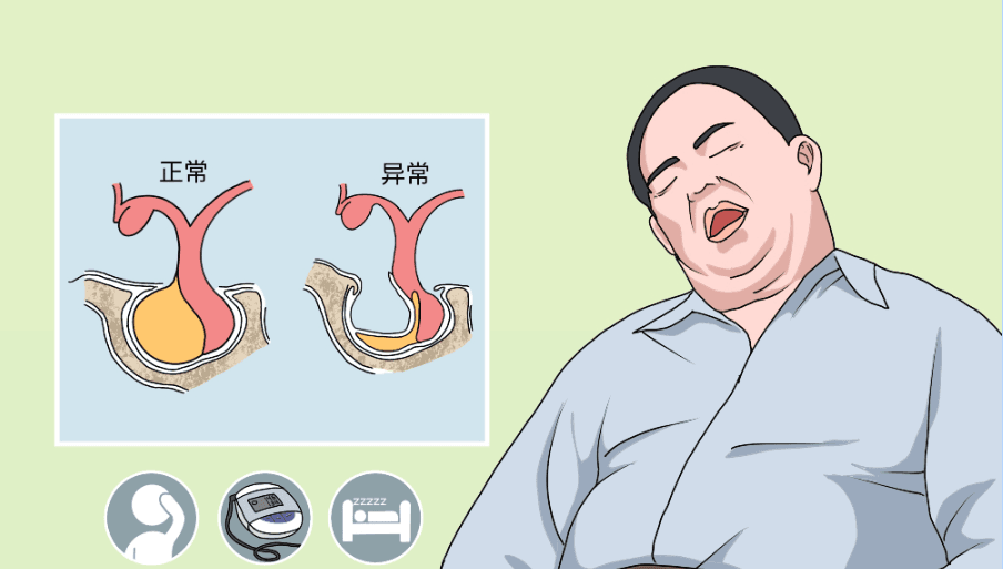 空泡蝶鞍是什么病？症状、诊断与治疗全解析