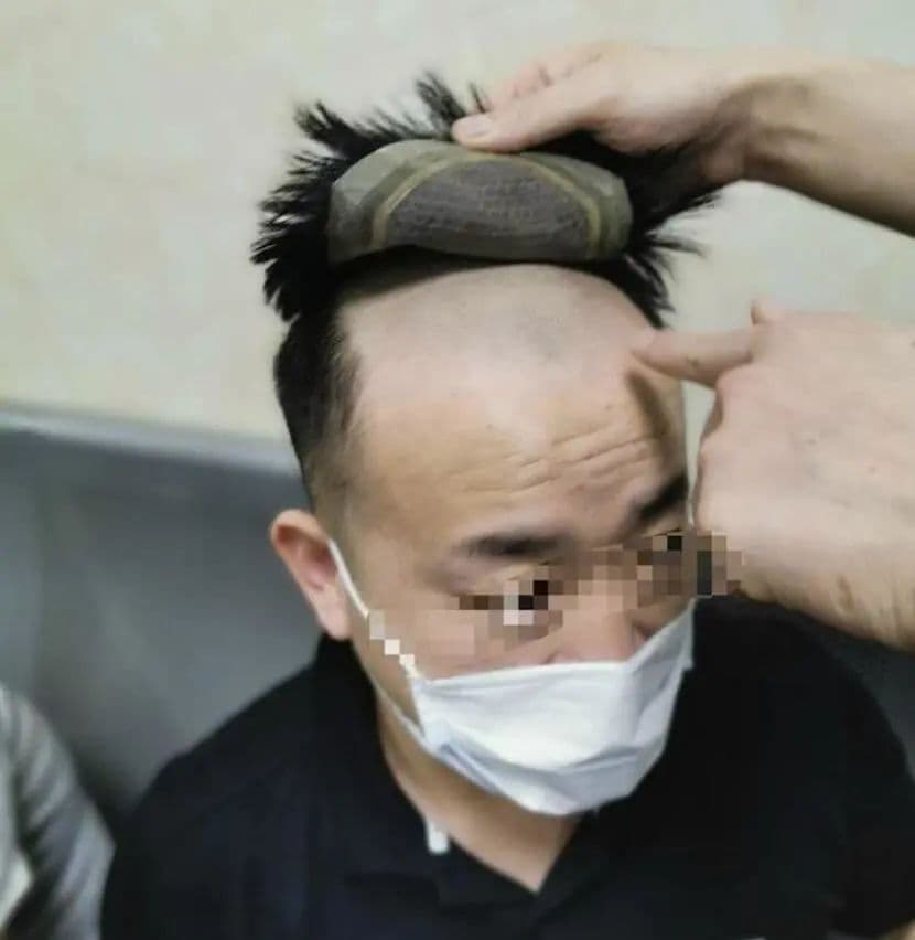 “瘾君子”染发、剃光头就能逃避检查？真相其实是……
