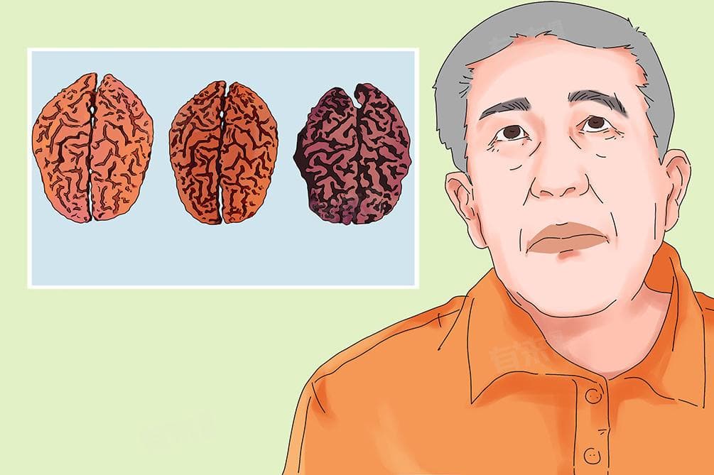 脑萎缩要怎么治疗才能好