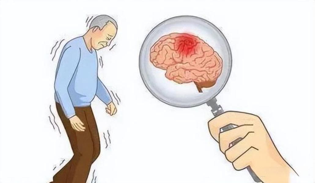 预防脑梗复发，生活中要注意哪些事情？