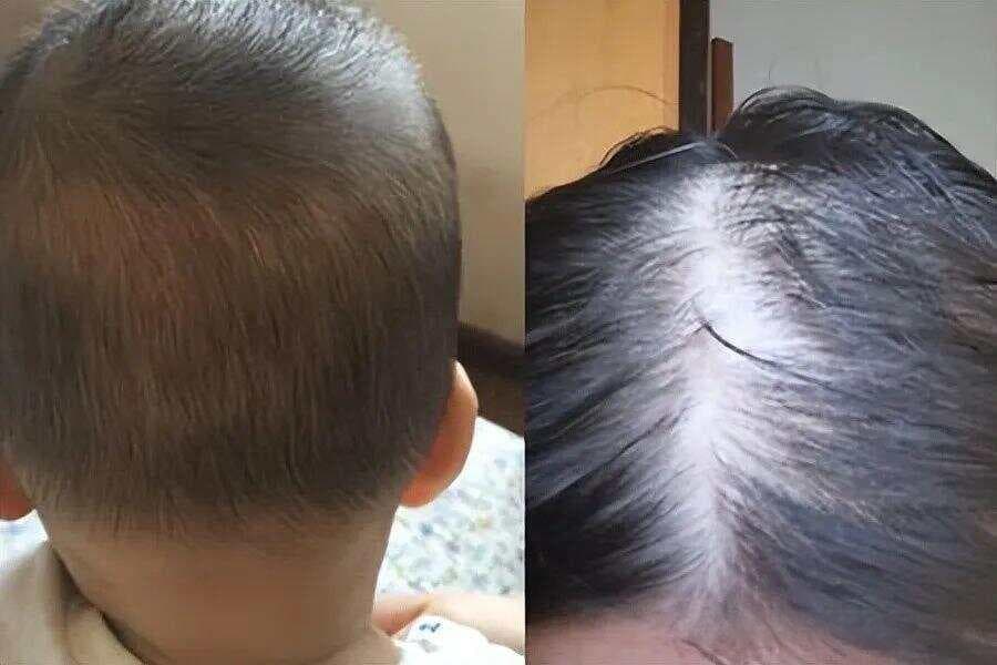 剃头改善宝宝发质，没有科学依据！头发是否浓密与4点有关