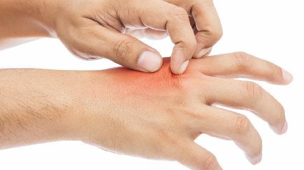 春季急性血小板减少的5大治疗方法：糖皮质激素、免疫调节剂等全面解析