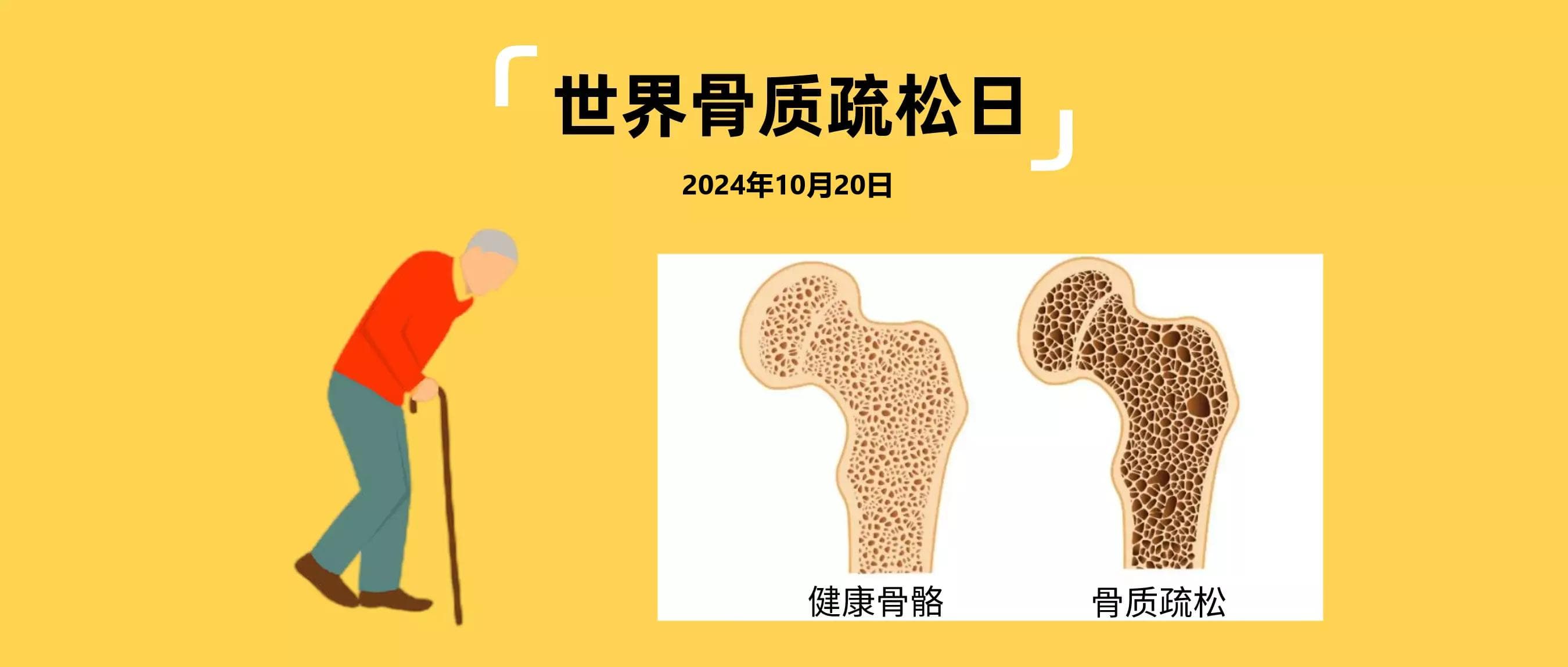 骨质疏松治疗市场增17.94%，双膦酸盐占据九成份额