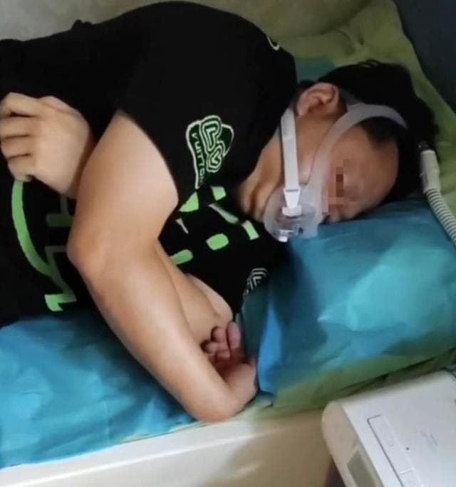 专家推荐：正压通气疗法改善睡眠呼吸暂停