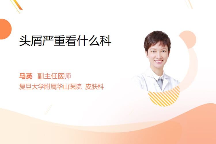 头屑严重看什么科
