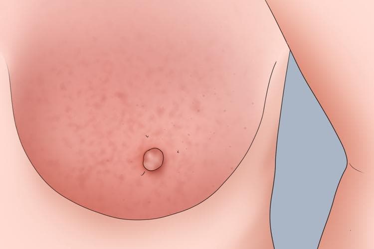 妇科能看乳腺吗？医生这样说
