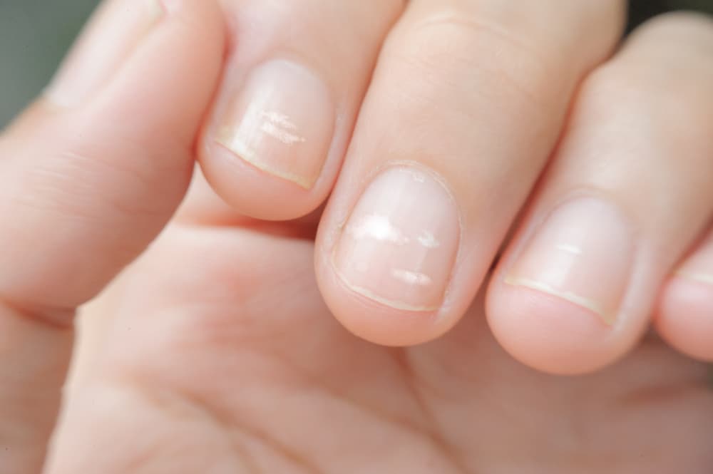 看指甲，知健康，指甲透露的 7 种健康信号！